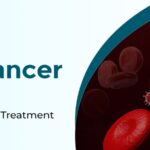 Is Blood Cancer Curable? Types, Causes, and Leukemia Treatment