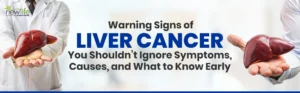 Read more about the article Warning Signs of Liver Cancer You Shouldn’t Ignore: Symptoms, Causes, and What to Know Early