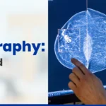 AI in Mammography: What Patients Should Know in 2026