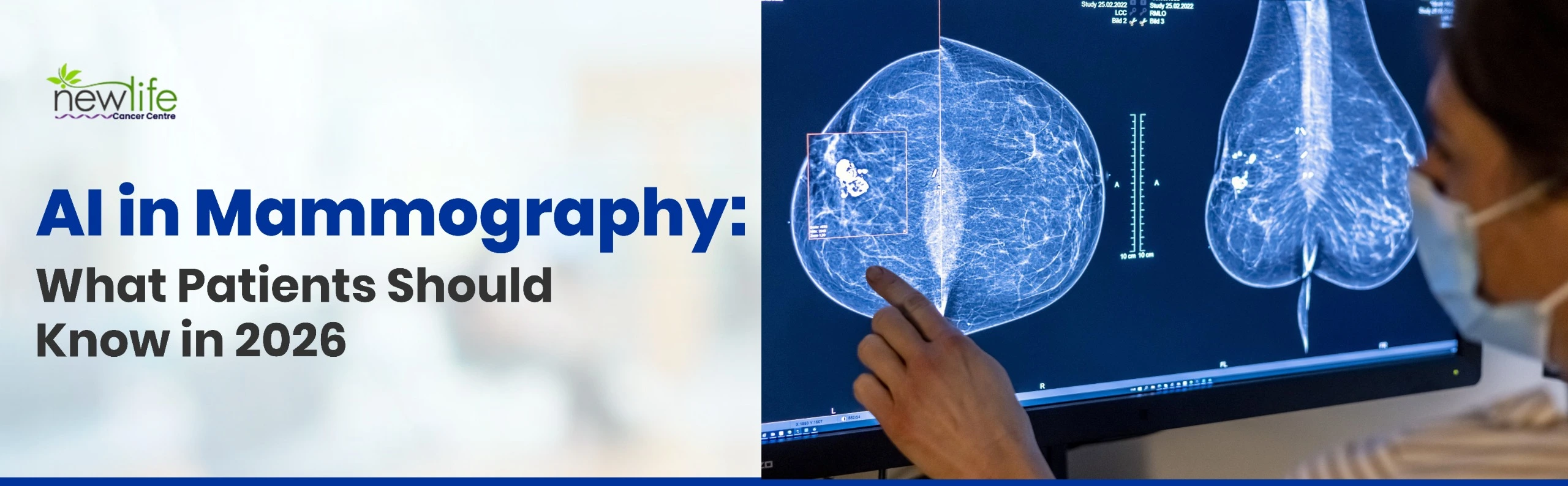 Read more about the article AI in Mammography: What Patients Should Know in 2026