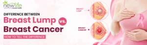 Read more about the article Difference Between Breast Lump vs Breast Cancer: How to Tell the Difference