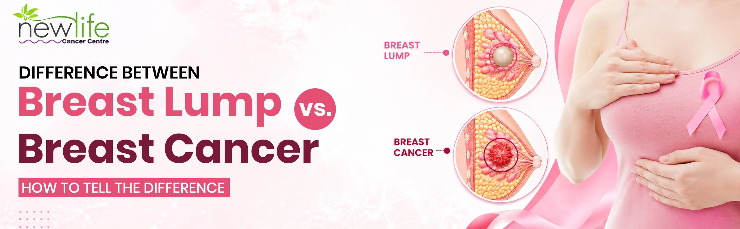 You are currently viewing Difference Between Breast Lump vs Breast Cancer: How to Tell the Difference