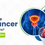 Can You Have Prostate Cancer Without Symptoms? Signs, PSA & Detection